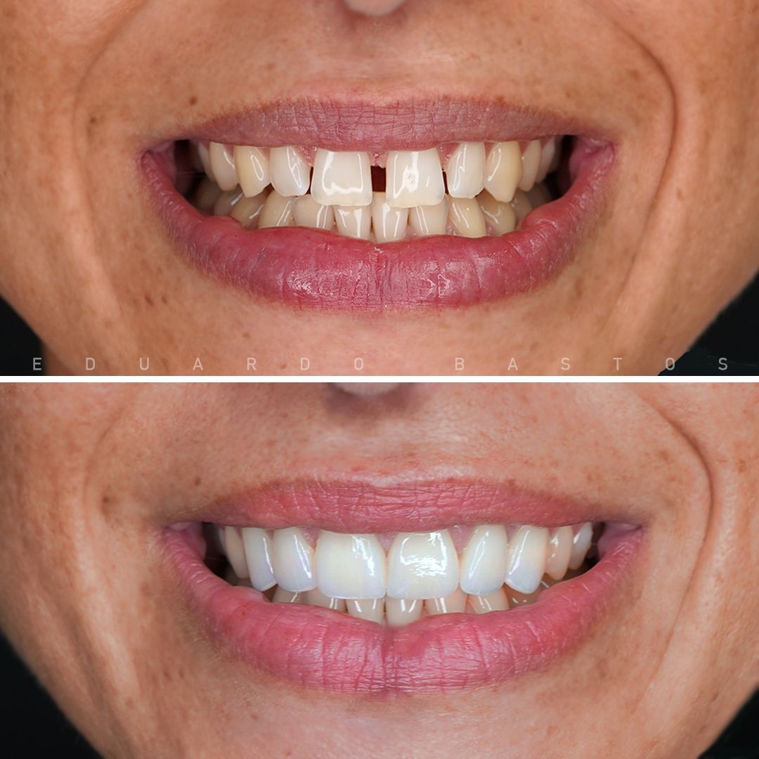 Dr Raheem's Dental clinic Chattiparamb
