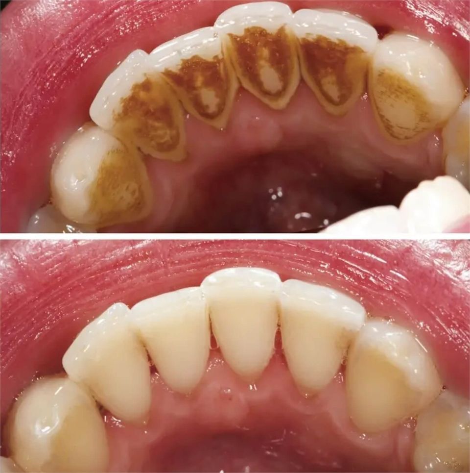 Dr Raheem's Dental clinic Chattiparamb