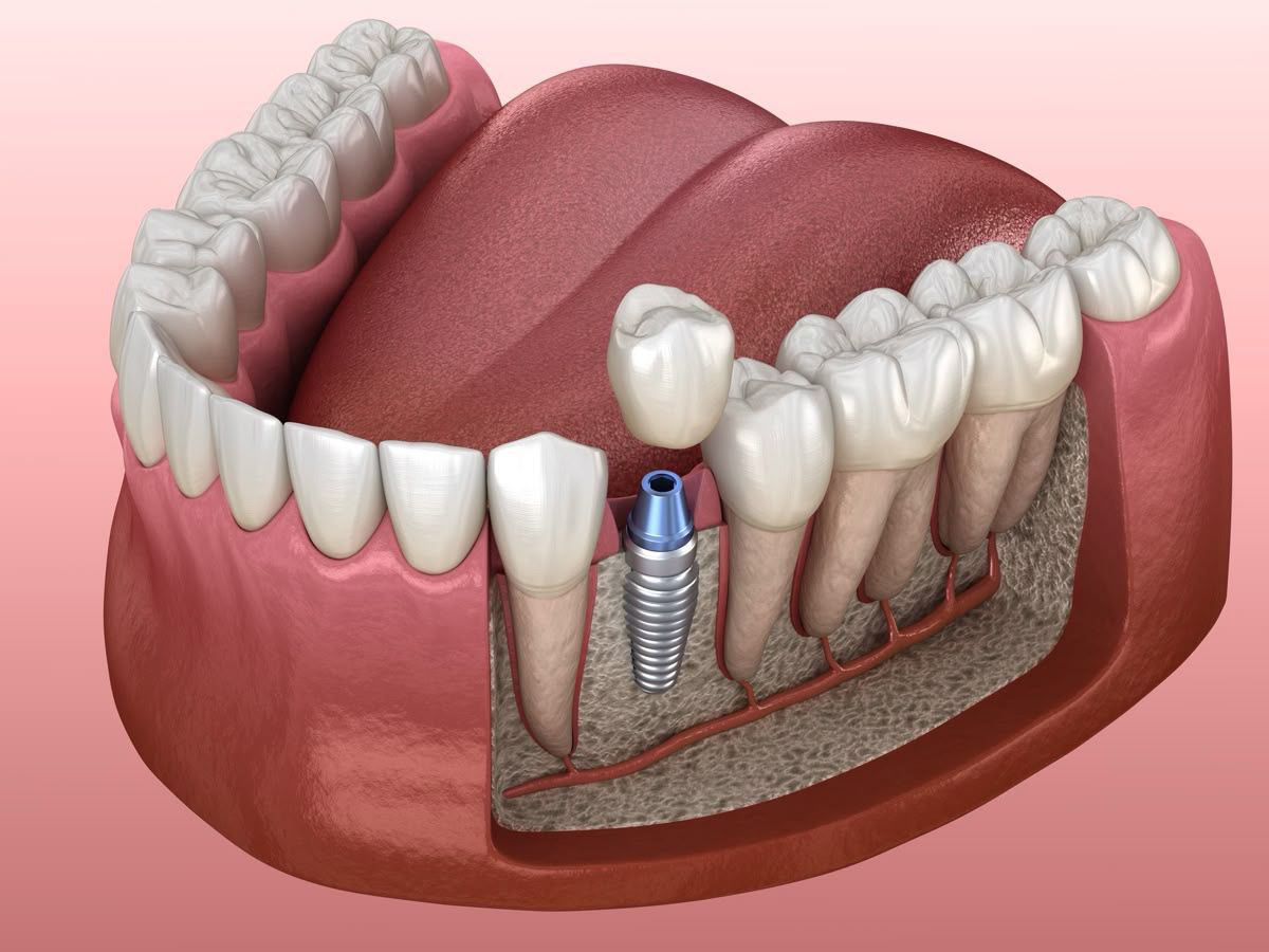 Dr Raheem's Dental clinic Chattiparamb