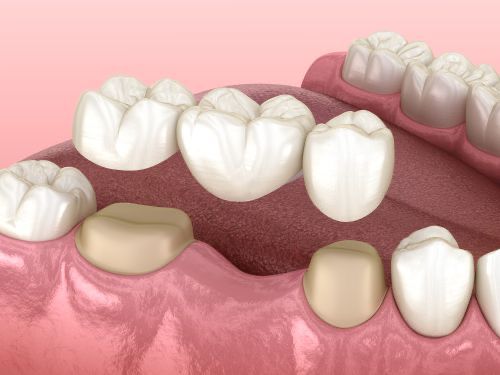 Dr Raheem's Dental clinic Chattiparamb
