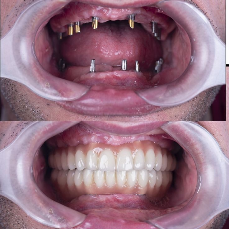 Dr Raheem's Dental clinic Chattiparamb