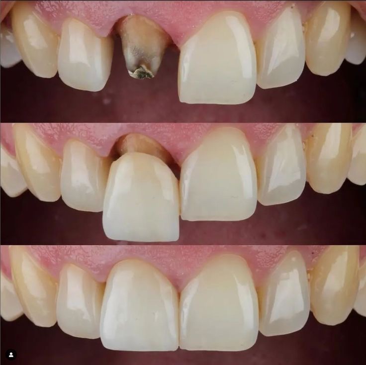 Dr Raheem's Dental clinic Chattiparamb