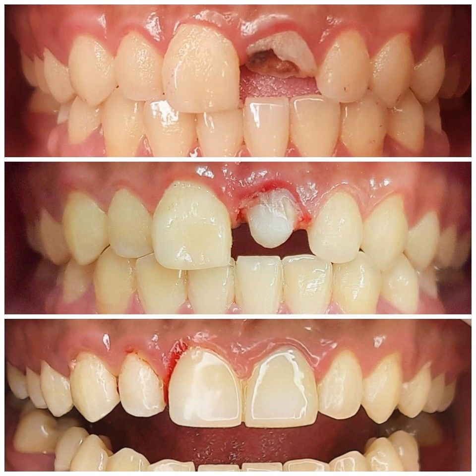 Dr Raheem's Dental clinic Chattiparamb